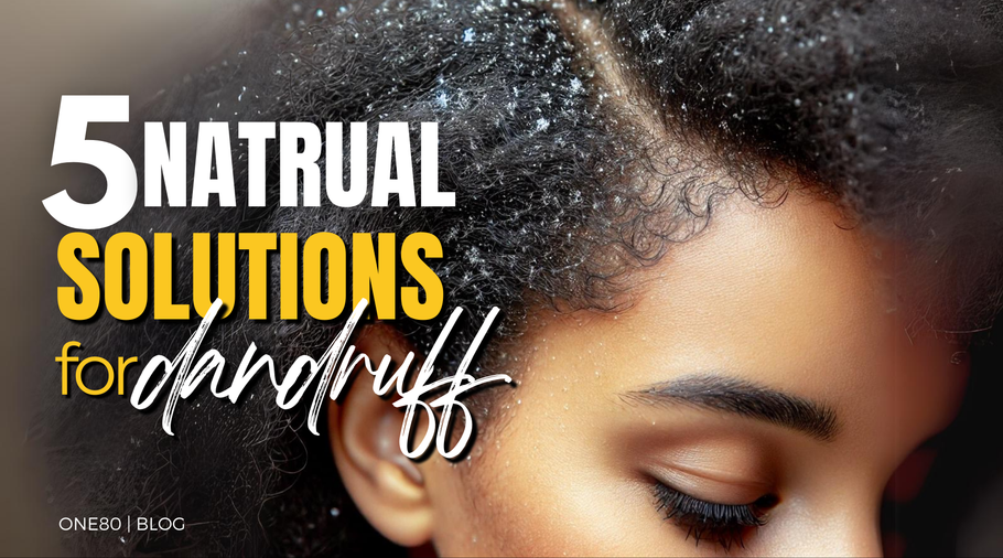 5 Natural Ways to Get Rid of Dandruff