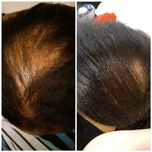 FREE SAMPLE: the Balm! Hair Growth Treatment